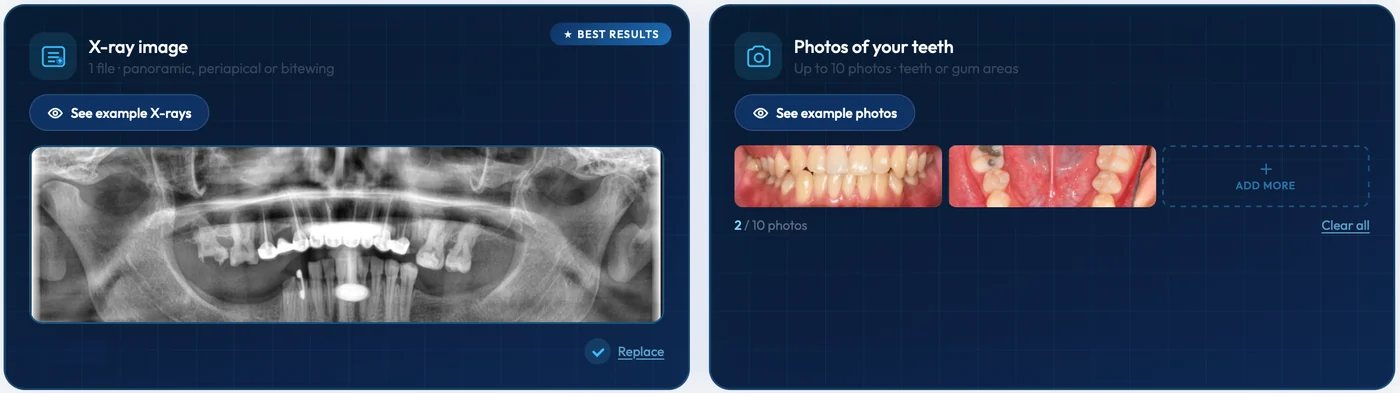 Lumben patient upload page with a panoramic X-ray and two intraoral photos added.